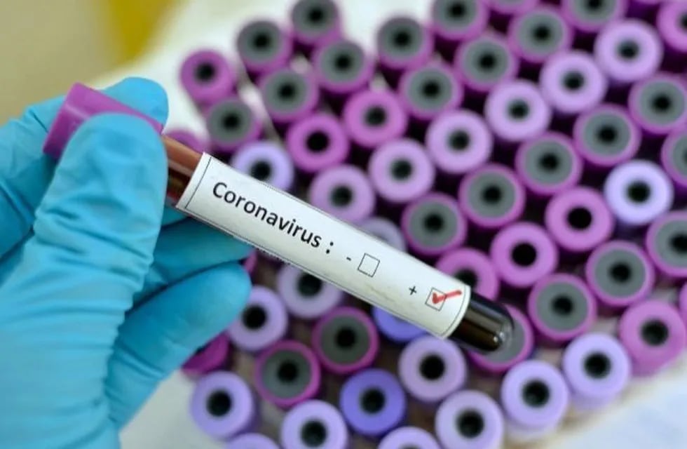 Coronaviruss