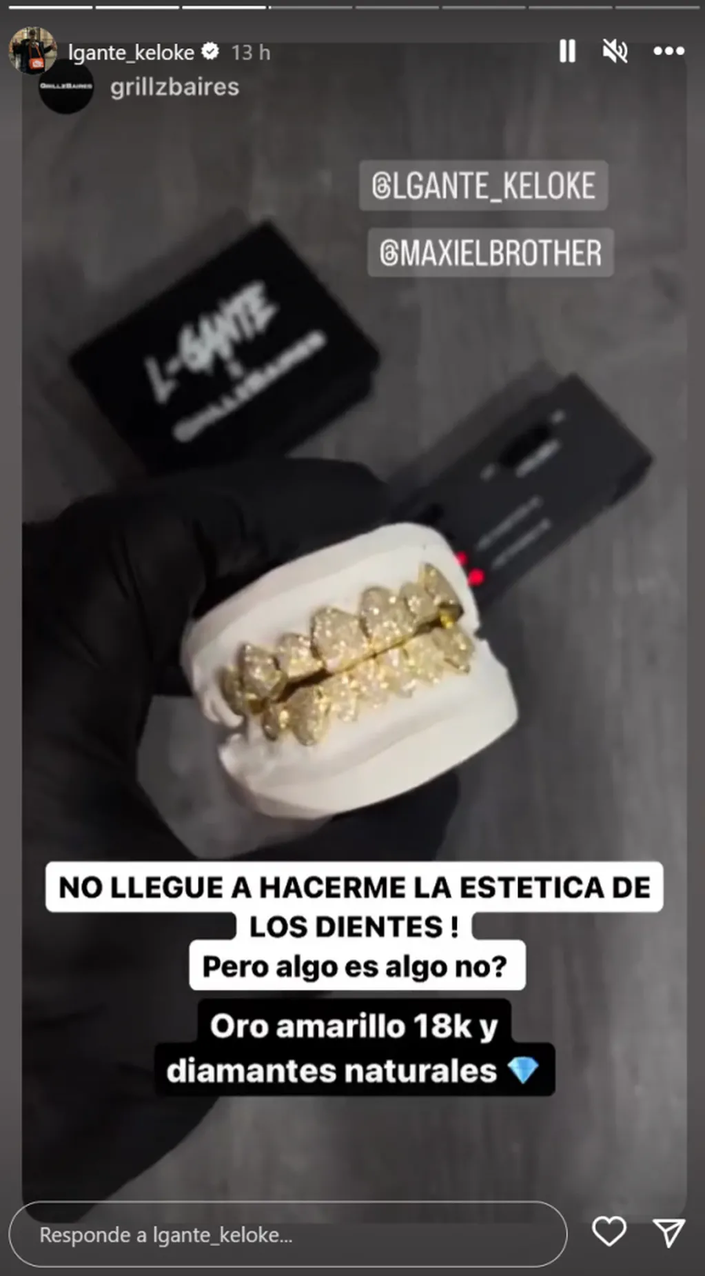 La nueva dentadura postiza de L-Gante hecha de oro y diamantes