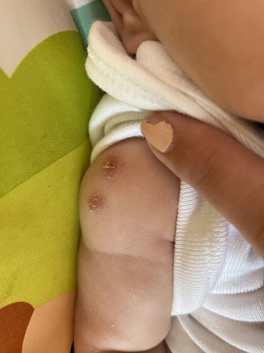 A uno de los bebés le pusieron dos veces la misma vacuna.