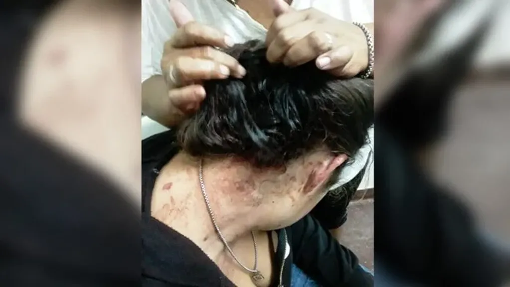 Violencia de género en Posadas terminó con una mujer asistida.