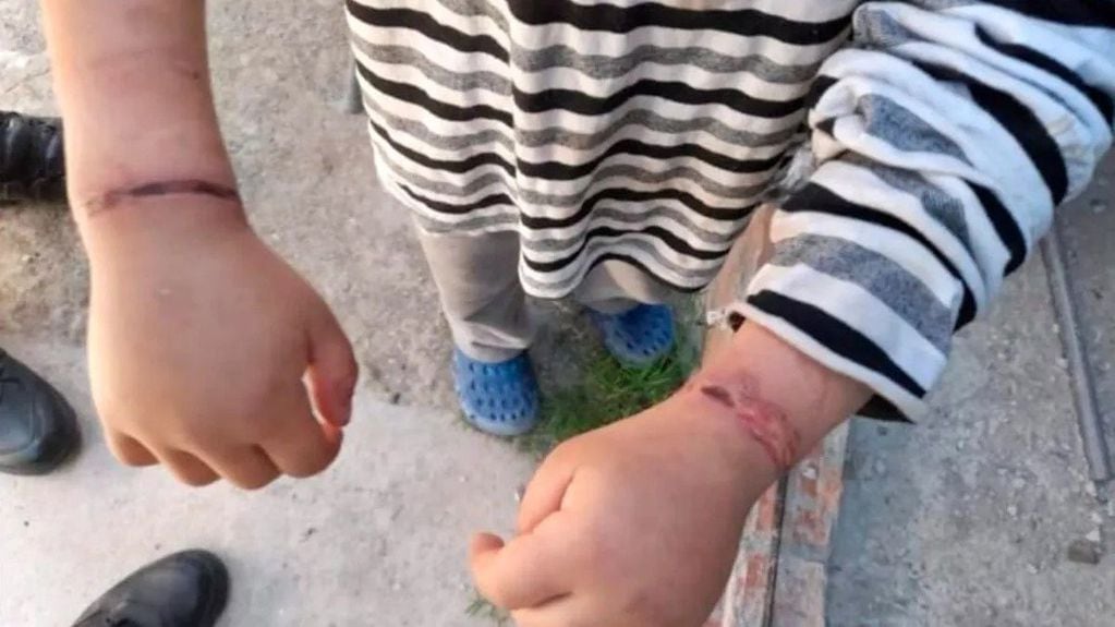 Un nene fue encontrado en su casa atado con alambres y su hermana con síntomas de desnutrición