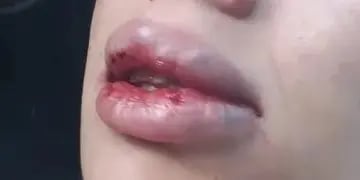 Mujer golpeada