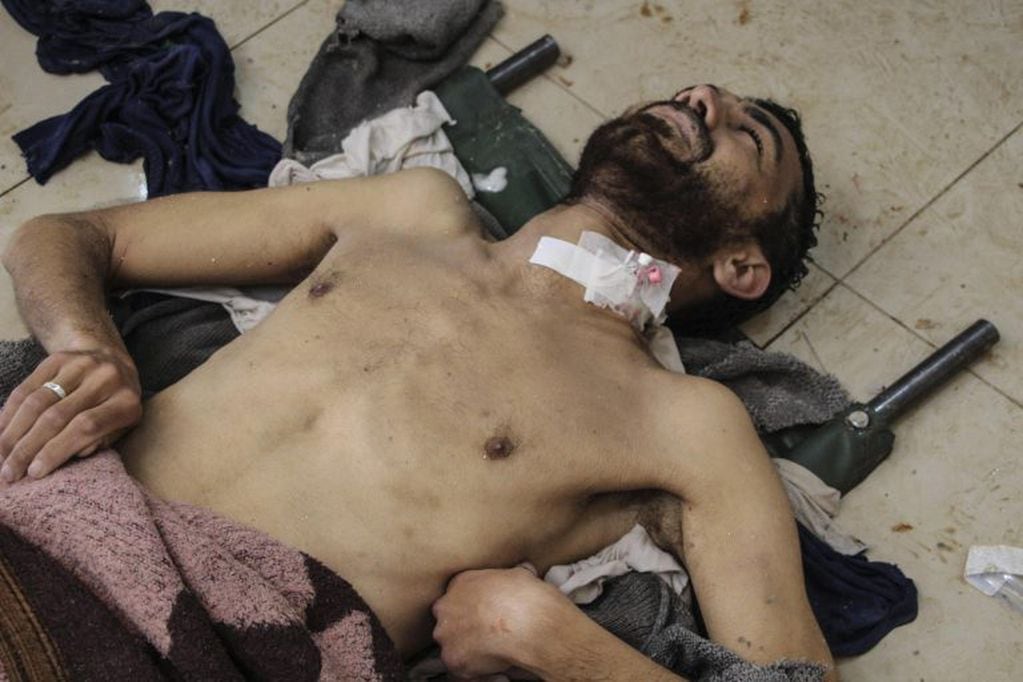 S4 IDLIB (SIRIA), 04/04/2017.- Un hombre recibe tratamiento médico tras un supuesto ataque químico contra la localidad de Jan Shijún, en el sur de la provincia septentrional de Idleb, en Siria, hoy, 4 de abril de 2017. Una fuente militar siria de alto ran