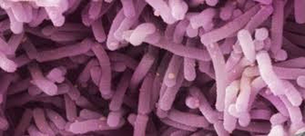 bacterias acido lácticas