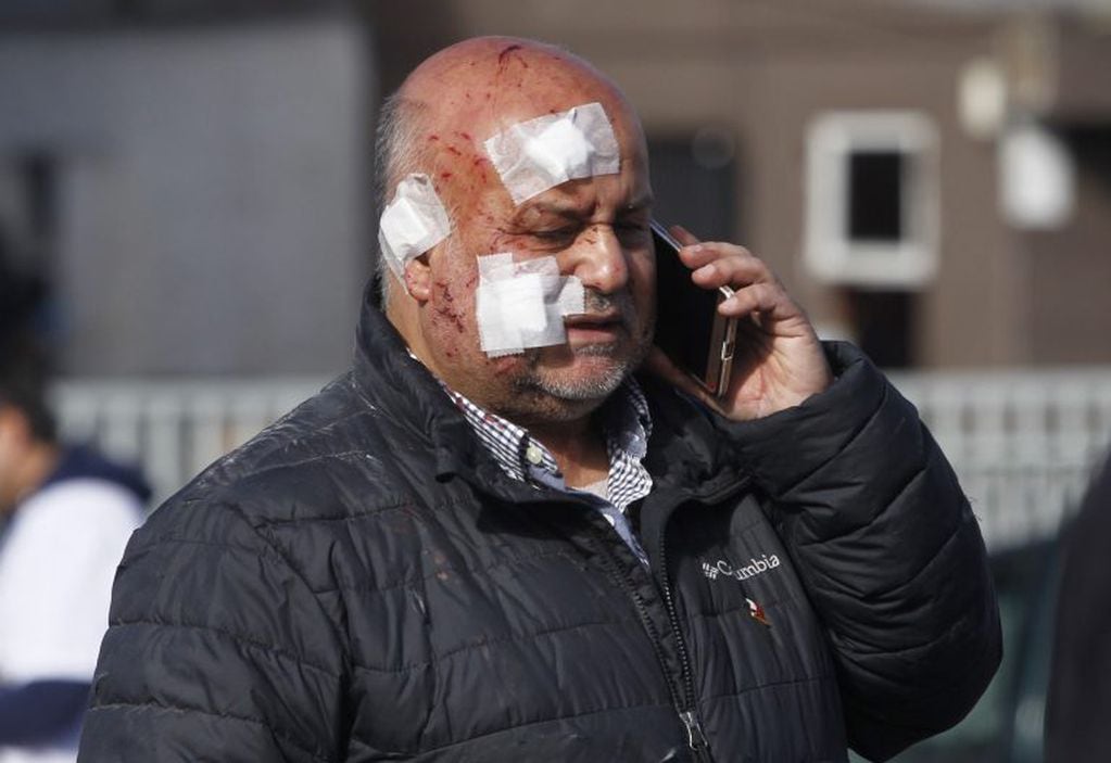 Uno de los heridos por la explosión en el sanatorio Alemán de Concepción, Chile. / AFP PHOTO / ATON CHILE / Dragomir YANKOVIC /