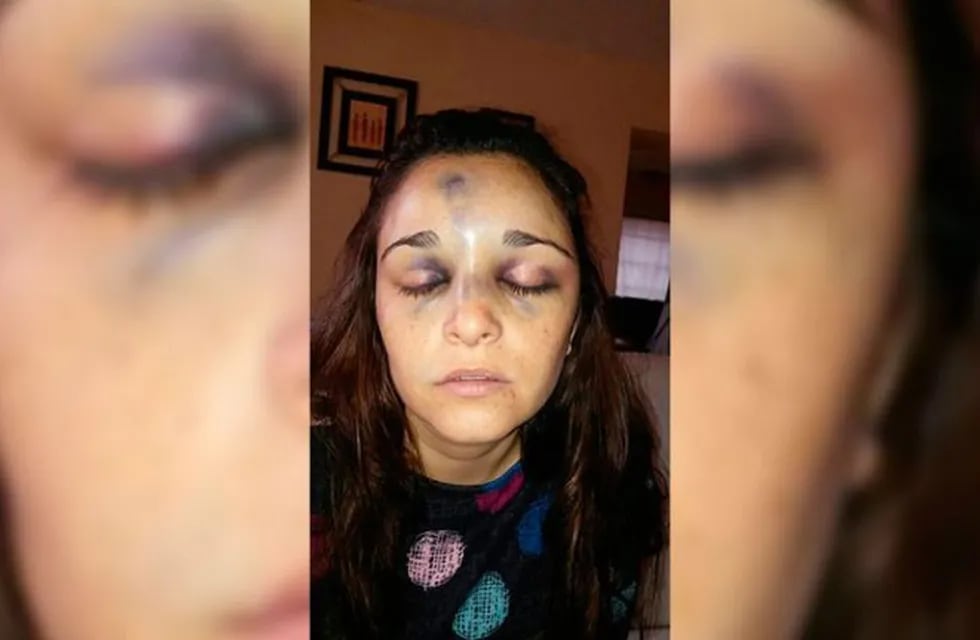 Carla Pereira, chica golpeada en san Luis.