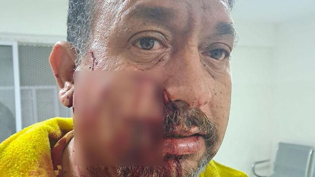 Un taxista fue agredido en Córdoba.