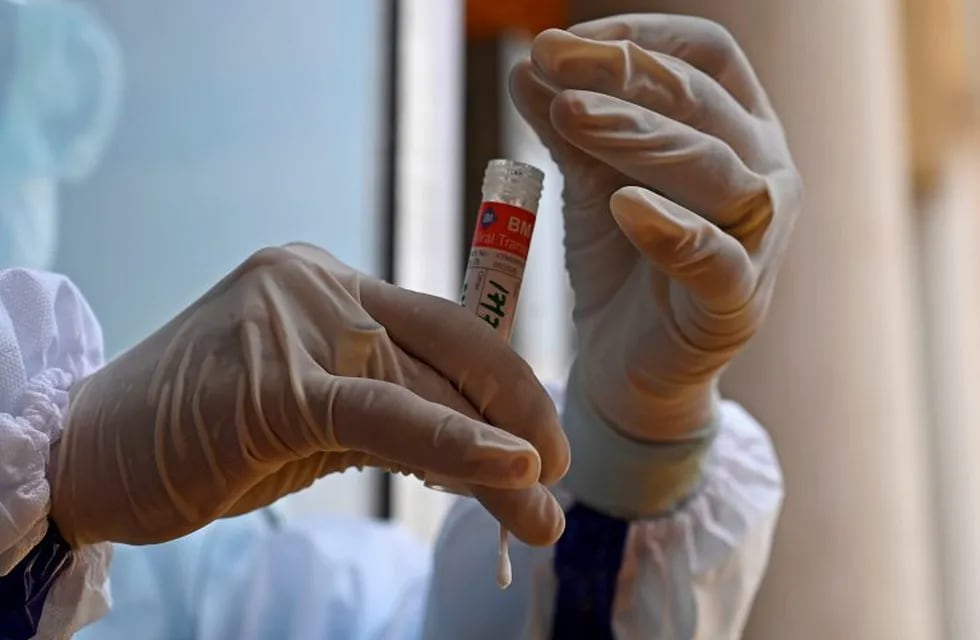 A health worker holds a nasal swab sample to be tested for COVID-19 coronavirus at a testing centre in Srinagar on July 17, 2020. - EU leaders met face to face on July 17 to try to rescue Europe's economy from the ravages of the coronavirus pandemic, as India became the third country to record one million cases, joining Brazil and the United States. (Photo by TAUSEEF MUSTAFA / AFP)
