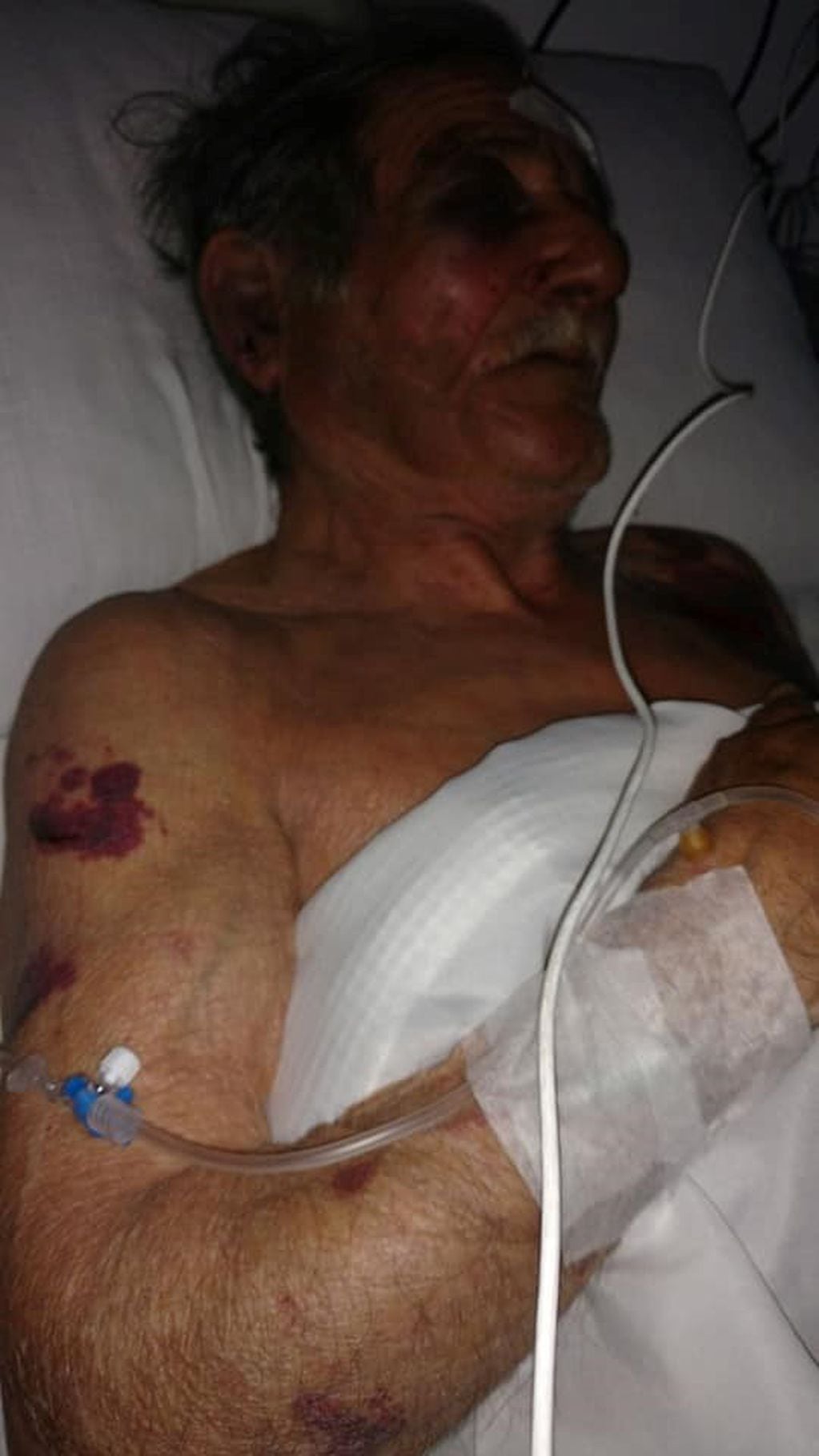 Ramón Peralta hospitalizado tras la golpiza.