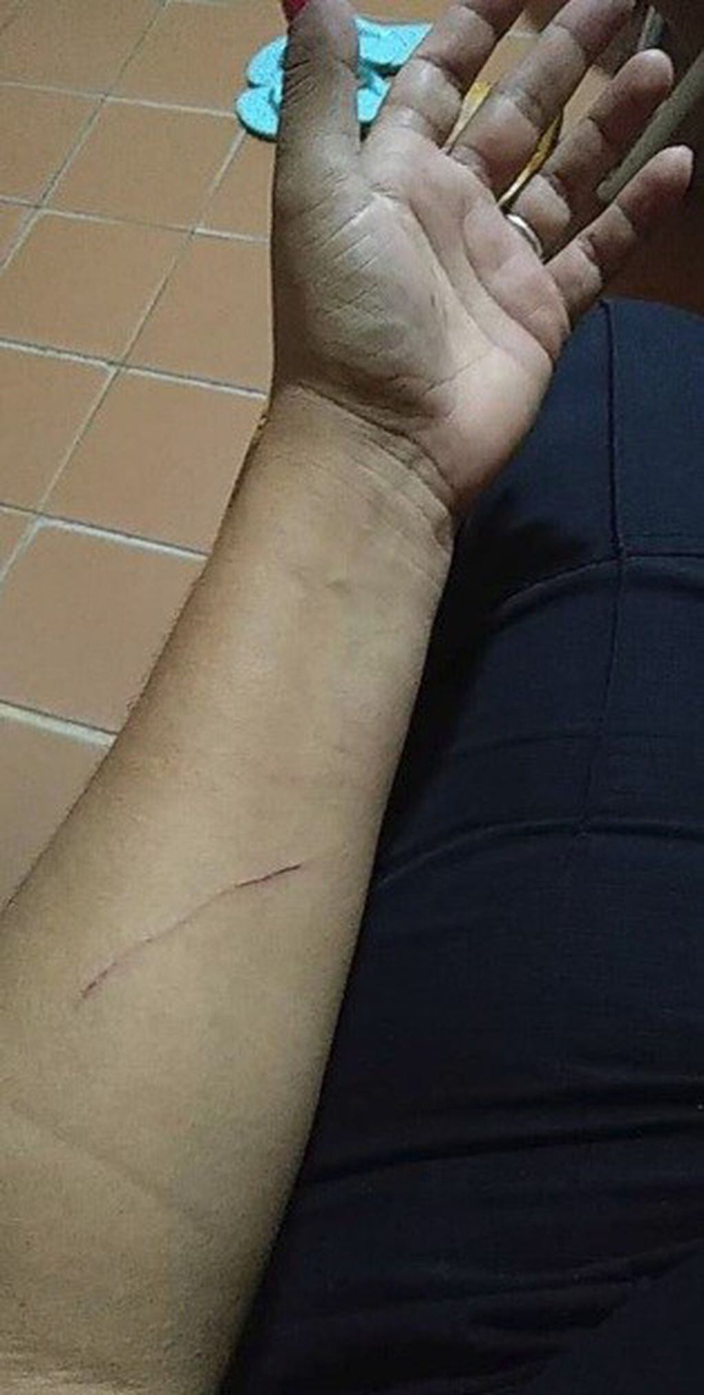 Una mujer policía recibió una brutal golpiza a la salida de un boliche. (Foto: Facebook)