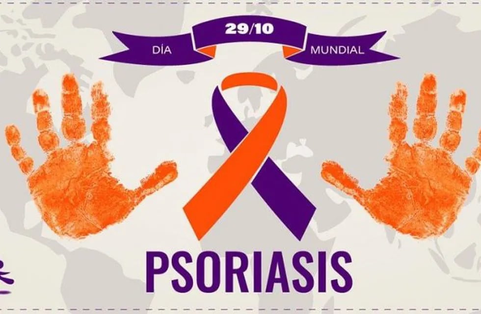 Inicia la campaña de detección de pacientes con psoriasis a nivel nacional y en las provincias. (Web).