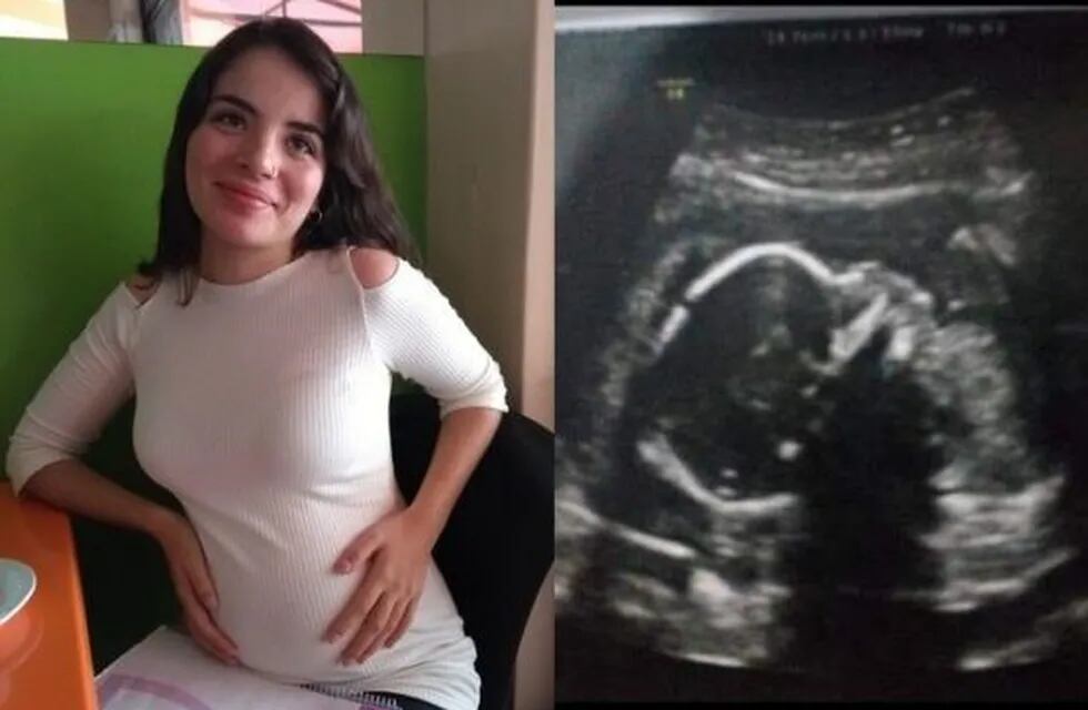 Tiene seis meses de embarazo y para que su beba nazca con vida debe viajar a EE.UU.