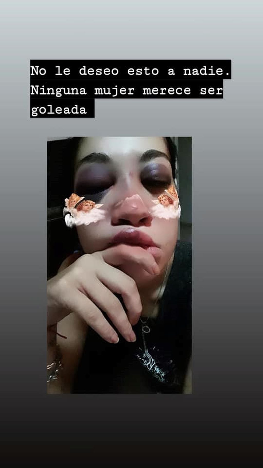 Melisa Rivera golpeada por su ex