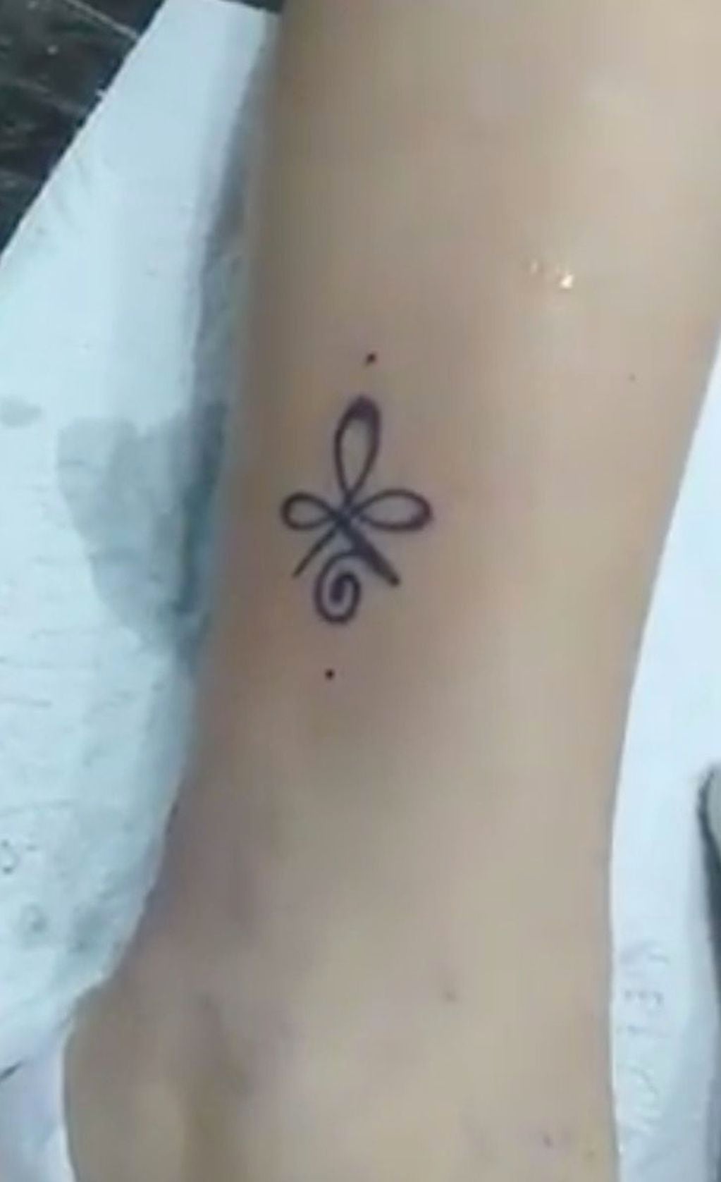 El resultado del tatuaje que fue realizado en la pierna de la niña.