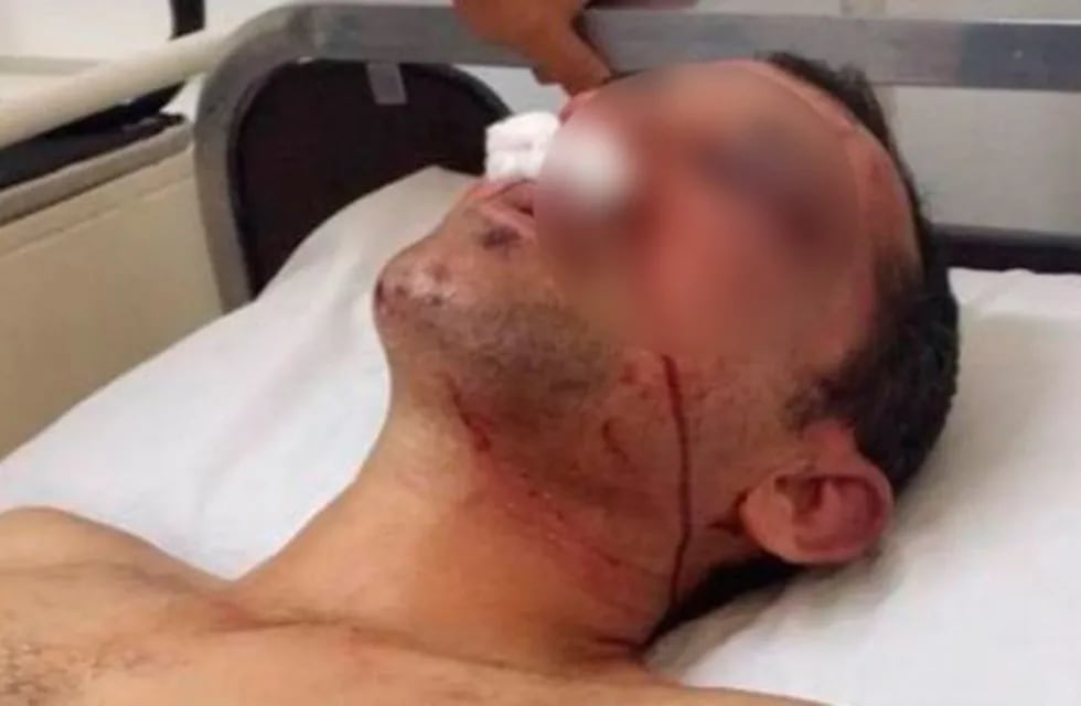 Javier Metzler fue agredido el pasado domingo en Basavilbaso\nCrédito: Web