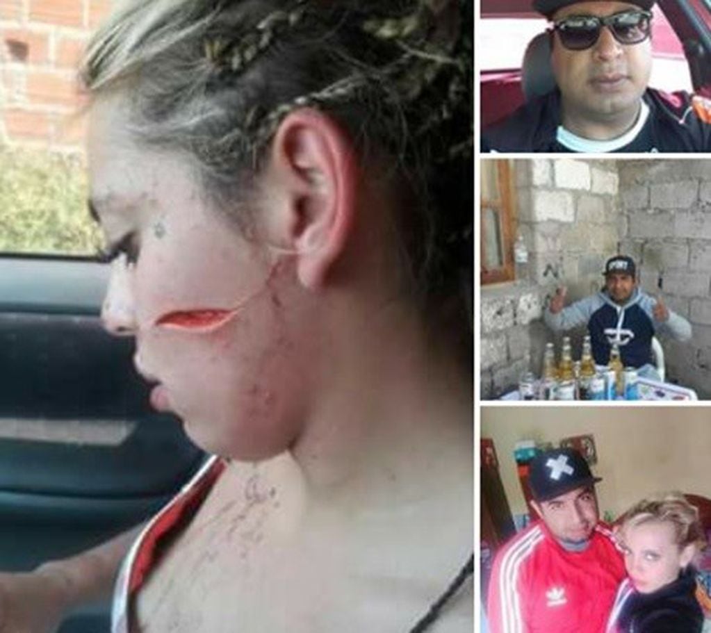 La mujer decidió realizar la denuncia vía Facebook al ver que la denuncia en la policía no surtía efecto.. (Web)