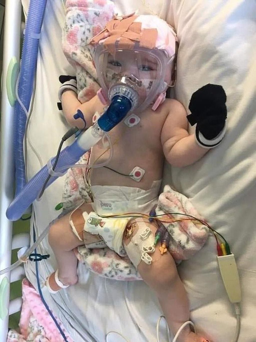 La historia de una beba que superó un trasplante de corazón y ahora tiene Coronavirus
