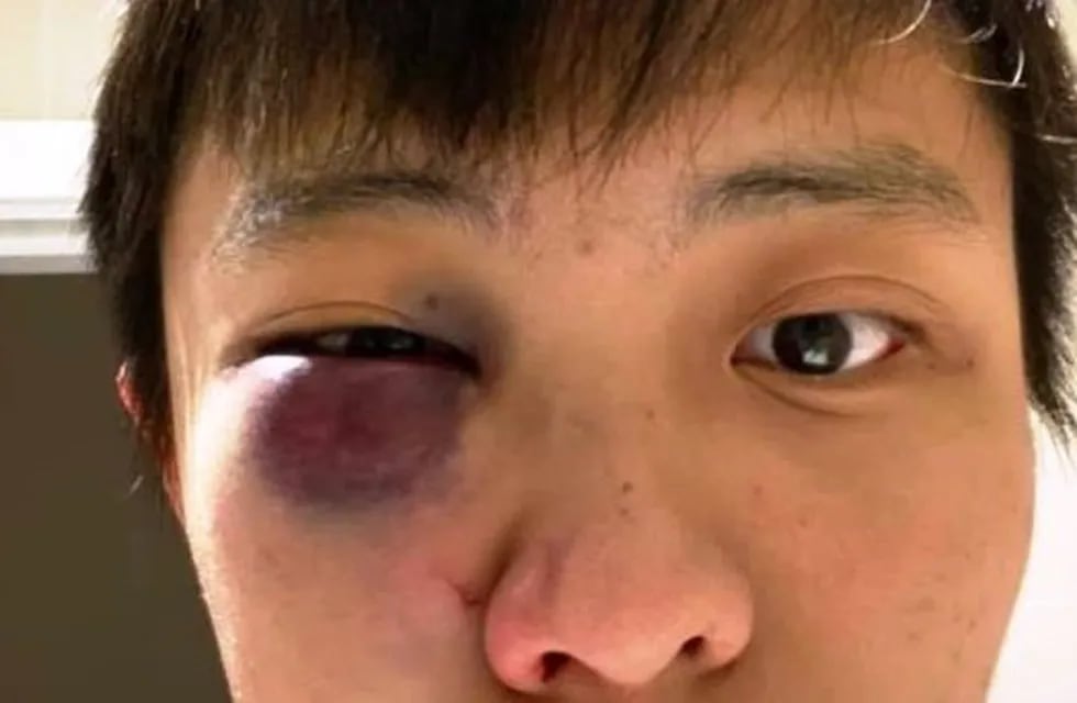 Jonathan Mok, víctima de una golpiza. (web)