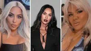 Qué es la bichectomía, el retoque estético de Kim Kardashian, Megan Fox y More Rial para lucir un rostro más delgado.
