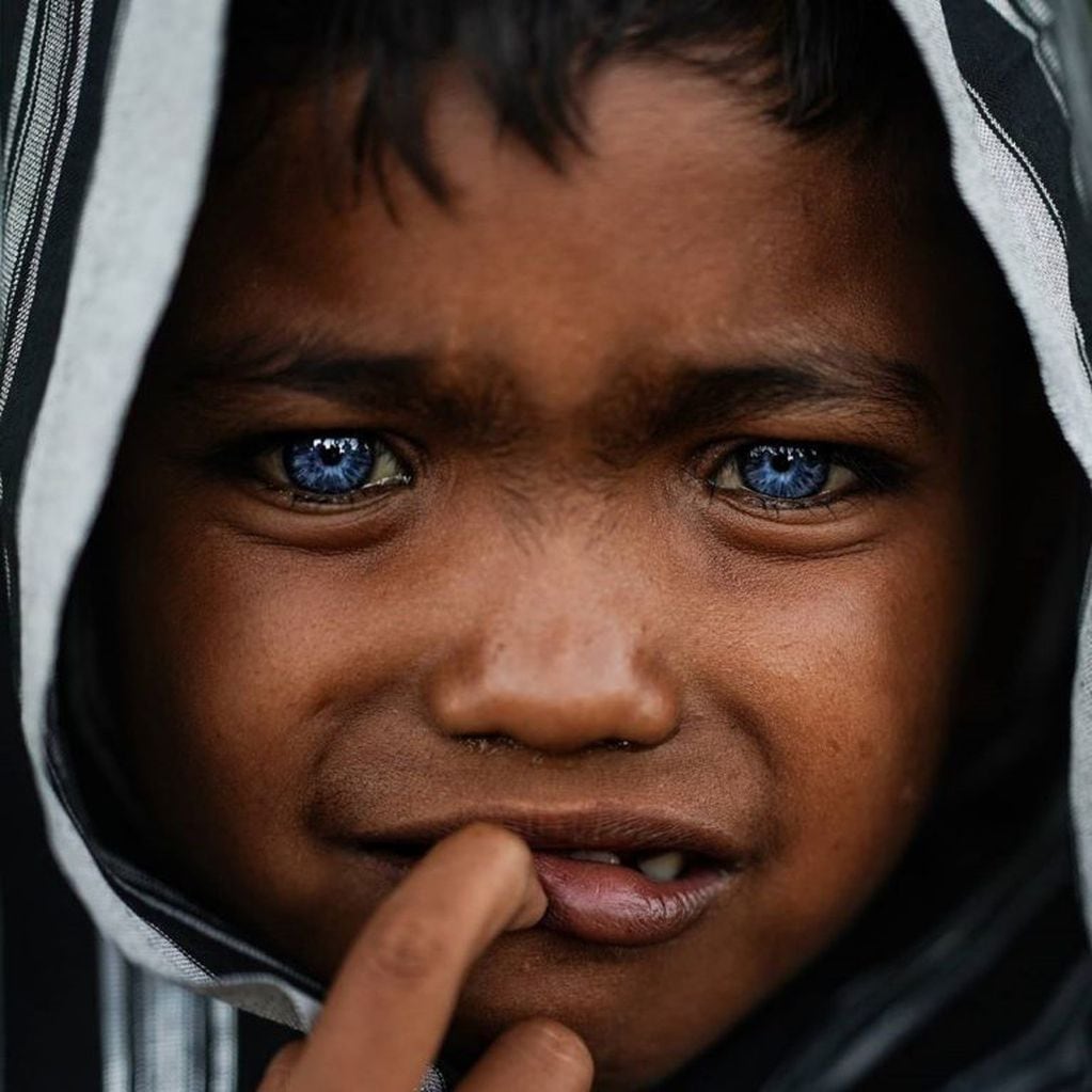 El color de los ojos puede ser por una mutación hereditaria. (Foto: geo.rock888)