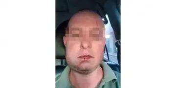 Carlos Galíndez, hombre atacado por policías en Río Cuarto