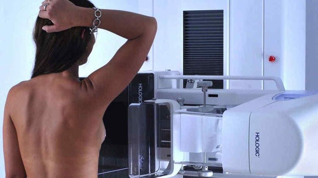 Detección temprana. La mamografía es la mejor forma de detectar en forma precoz el cáncer de mama.