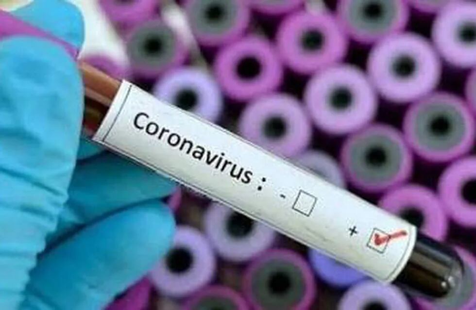 Coronavirus positivo