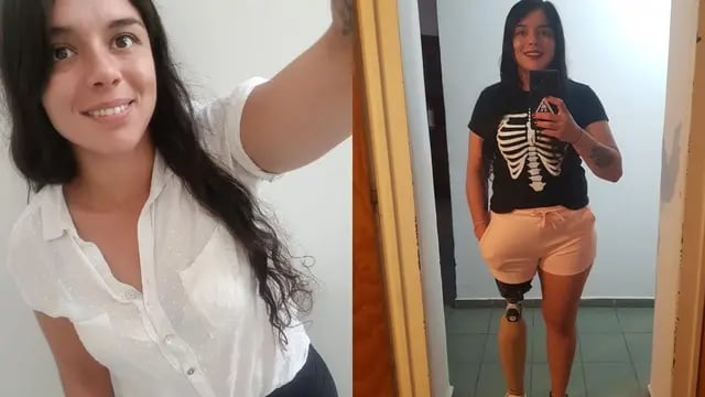 Estefanía González, deportista que necesita cambiar su pierna ortopédica.