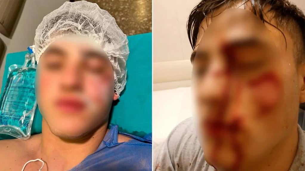 Nicolás García presentó varios cortes en la cara y una perdida de la visión de su ojo izquierdo. Foto: Web
