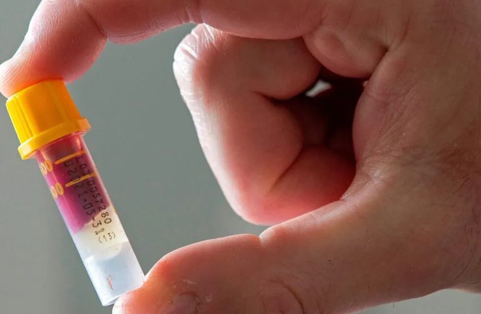A blood sample ready to be posted back to the Lab is pictured in a micro sampling collection tube, as a man uses an IgG Antibody Test Kit which identifies Immunoglobulin G antibodies related to SARS-CoV-2, the virus that causes COVID-19, in London on May 28, 2020, during the COVID-19 pandemic. - This type of test confirms if you have previously had the coronavirus as Financial Times research published Thursday, May 28 that Britain has suffered the highest death rate from the coronavirus among the most-affected countries with comparable tracking data. (Photo by JUSTIN TALLIS / AFP)