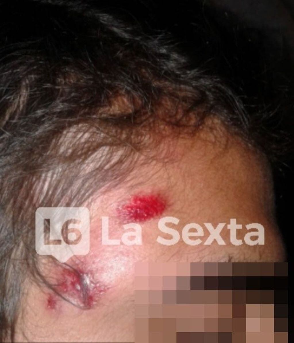 Violencia Policial en Santa Elena