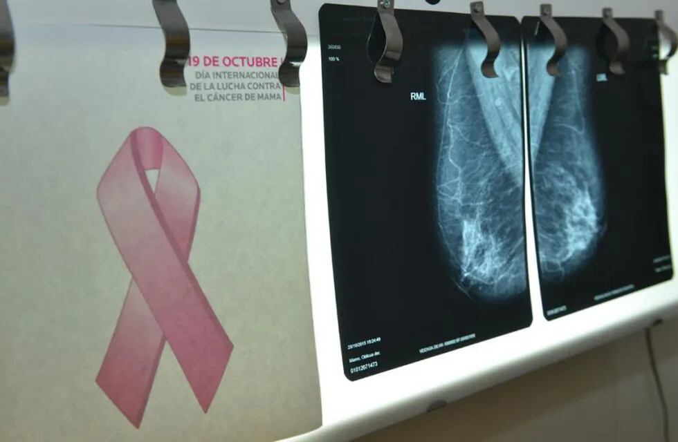 Por el mes de prevención del cáncer de mama, realizarán mamografías y testeos gratuitos. (La Voz/ Archivo)