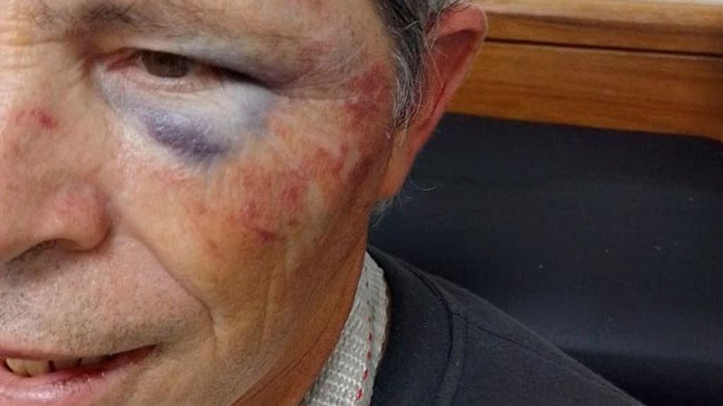 El hombre de 61 años fue golpeado ferozmente por otro conductor.