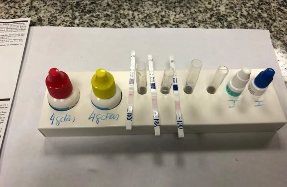 Streptococcus pyogene: los elementos necesarios para realizar el test