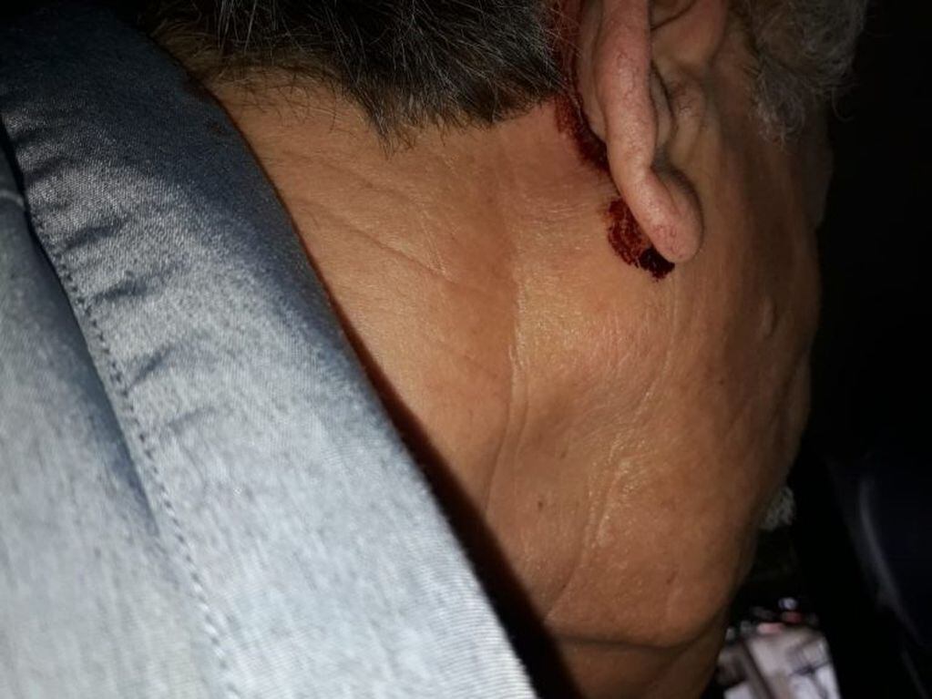 Alta Gracia: violento asalto a un remisero. Créditos: Mi Valle.