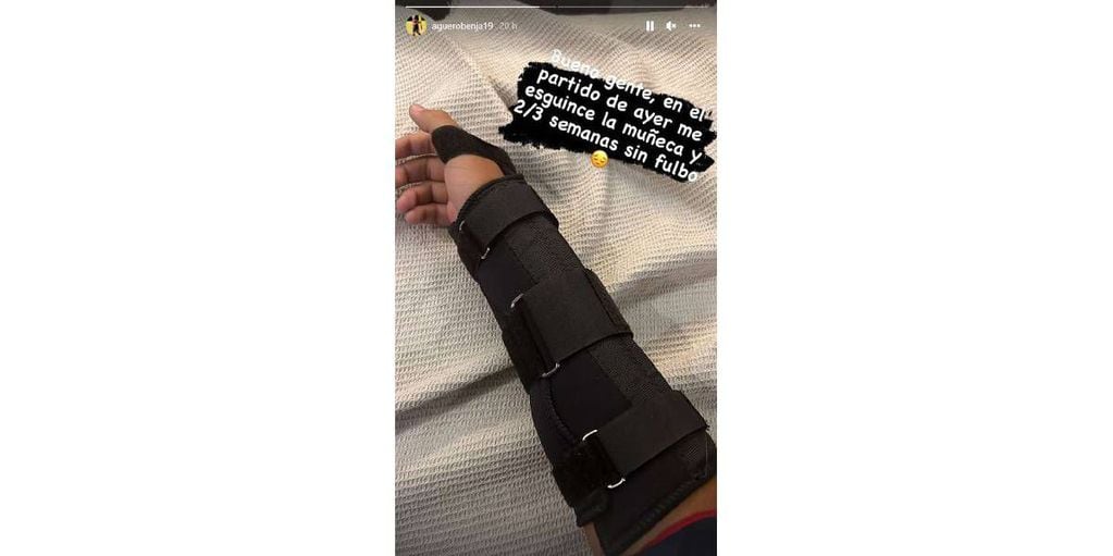La foto que compartió Benjamín Agüero de su lesión.