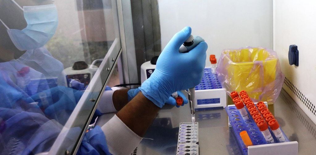 Investigadores brasileños aseguran que hallaron casos de co-infección con dos variantes del coronavirus.