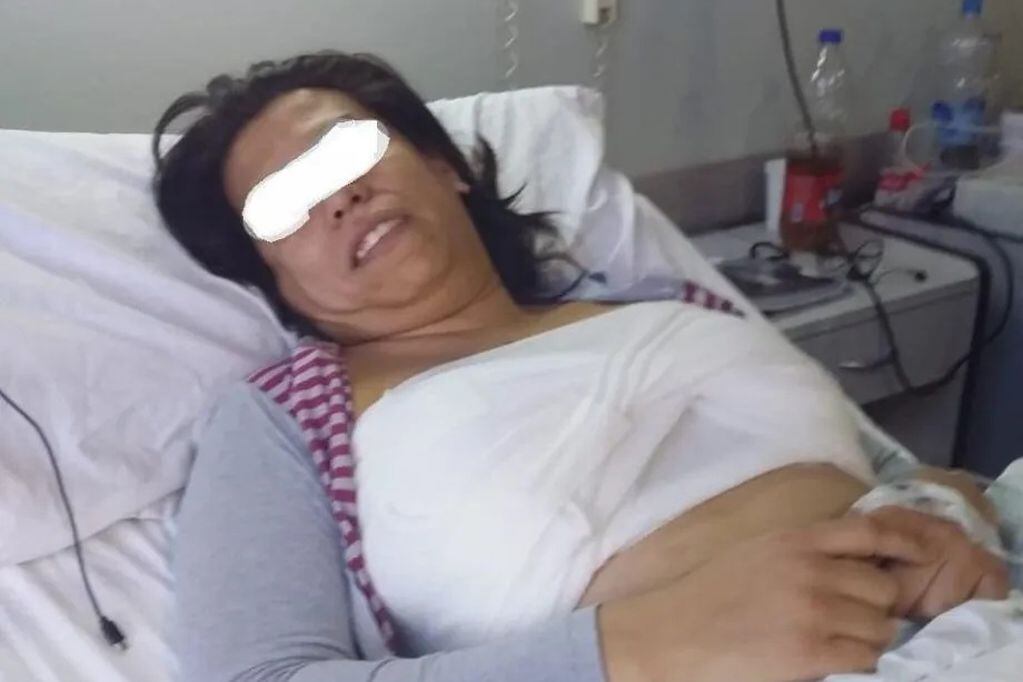 Eliana Romero, la sanjuanina trans de 35 que denuncia desatención en el hospital tras realizarse un implante mamario.