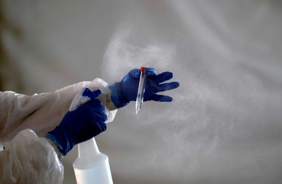 A laboratory worker cleans the tube containing a sample from a customer at the Certus Lab's COVID-19 drive-thru test centre at the parking lot of the Caliente multipurpose complex in Tijuana, Baja California State, Mexico, on July 21, 2020 amid the novel coronavirus pandemic. - As Mexico's public health COVID-19 testing rate is one of the lowest worldwide, private laboratories running certified testing have become an option for people that can afford it. (Photo by Guillermo ARIAS / AFP)