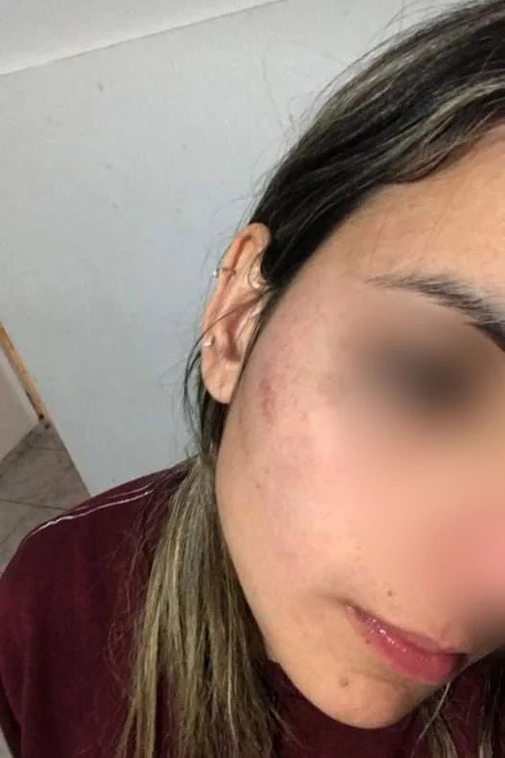 Violencia de género en San Luis: joven fue golpeada y amenazada de muerte por su expareja.