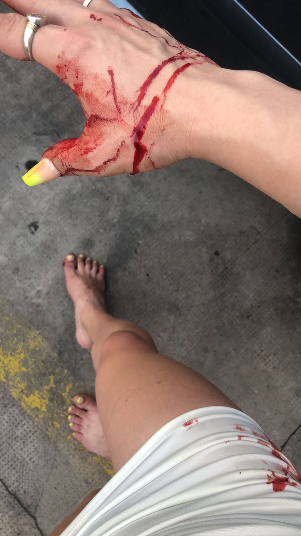 Las imágenes después de la brutal golpiza que recibió Daniela "La Mego".