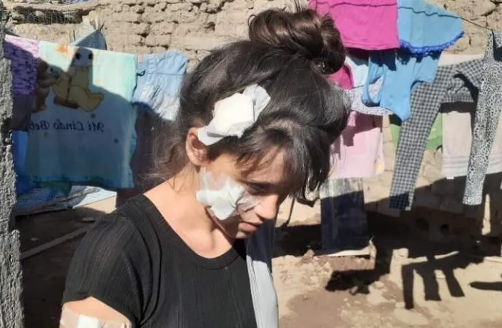 Rocío Tejada fue atacada por otra mujer en la puerta de su casa.