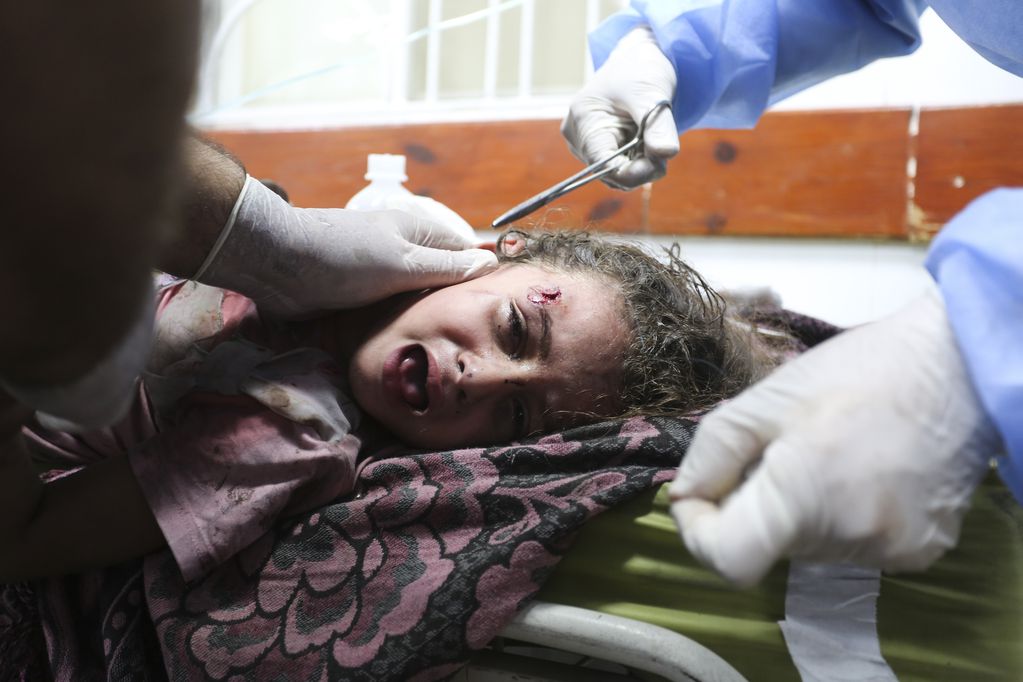Una niña palestina herida en un ataque israelí sobre la Franja de Gaza recibe tratamiento en un hospital en Rafah, el 30 de octubre de 2023. 