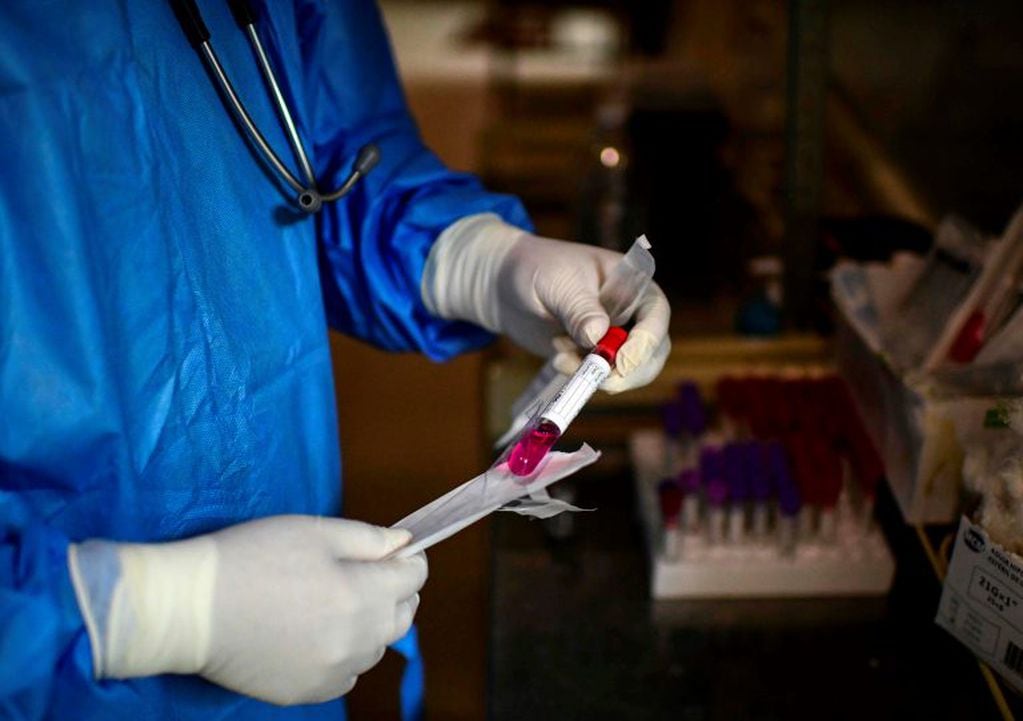 Test por coronavirus (Photo by RONALDO SCHEMIDT / AFP)