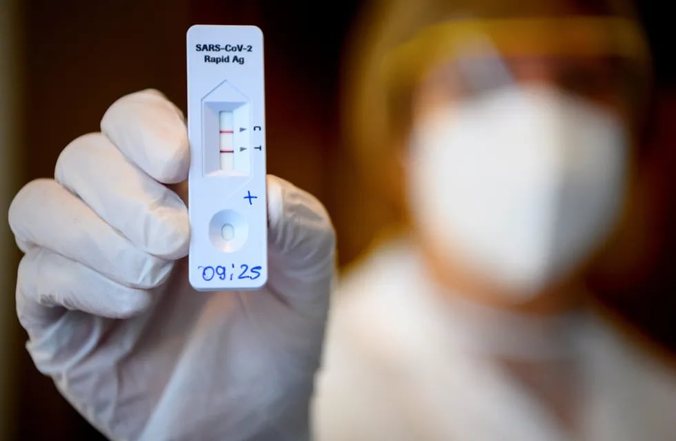 Pérez sumó 145 casos nuevos de coronavirus 
 (Laurent Gillieron/Keystone via AP)