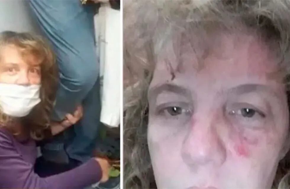 Una enfermera volvió a su casa, su vecino la golpeó y le roció la cara con desinfectante
