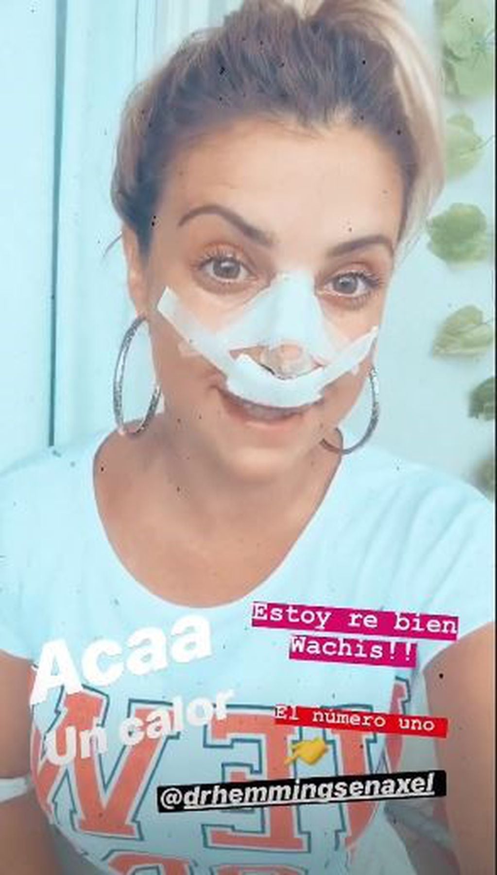 Bianca Iovenitti le contó a sus seguidores que pasó por el quirófano antes de viajar para hacer temporada de verano  (Foto: Instagram/ @bianiovenitti)