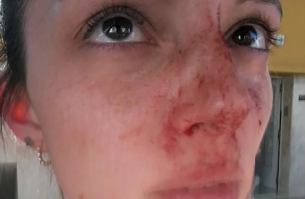 Araceli mostró en fotos cómo quedó su rostro luego de la agresión. (Facebook)