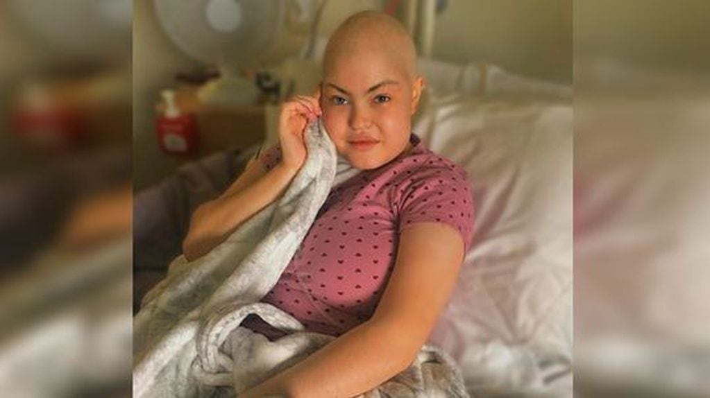 La foto de Jayda Mccann rapada producto de las consecuencias de las medicaciones y tratamientos que le administraron para luchar contra el cáncer  (Foto: Instagram/ @jaydamccannx)
