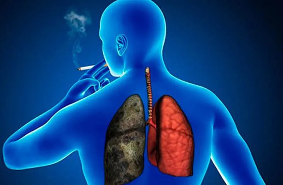 Afectación de los pulmones por la EPOC.